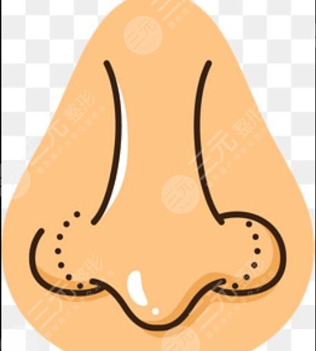 溫州一醫(yī)鄭君達做鼻子怎么樣