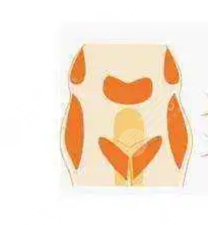 張一鳴個人資料簡介，附上玻尿酸填充案例