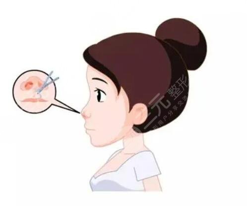 江映蓉到底做沒做整形手術(shù)，照片對比，鼻子越來越具有歐美范兒！