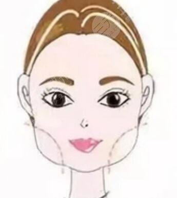 磨下頜角手術(shù)介紹