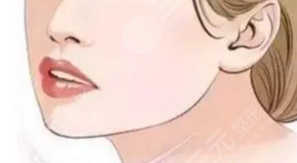 磨下頜角失敗案例