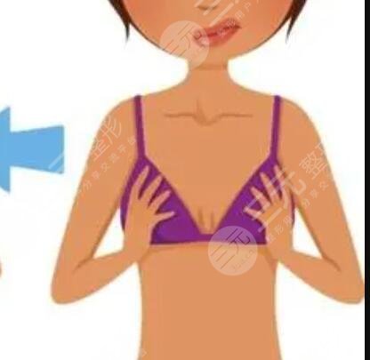 假體隆胸400cc多大