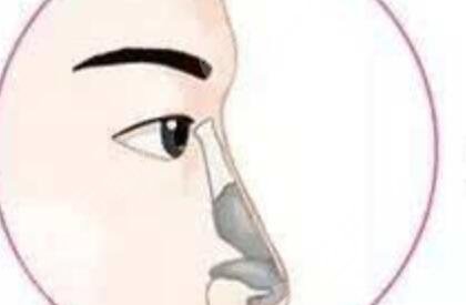 做雙眼皮手術(shù)之前