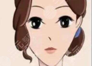 雙下巴抽脂術(shù)案例果:簡(jiǎn)單的一個(gè)手術(shù)告別油膩重獲V臉輪廓