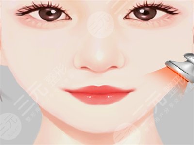 面部溶脂前后照片對比，3個月恢復(fù)正常！