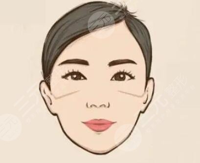 朱石江頜面案例真人圖片公開