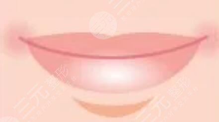 玻尿酸豐唇案例前