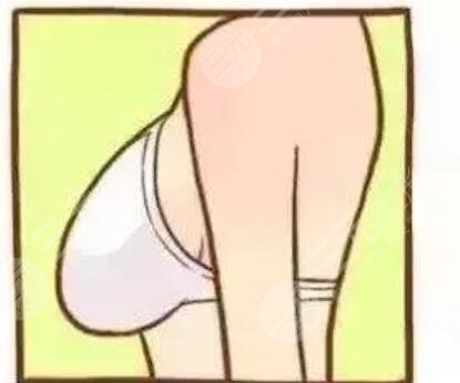 【c罩杯有多大圖片】隆胸筆記