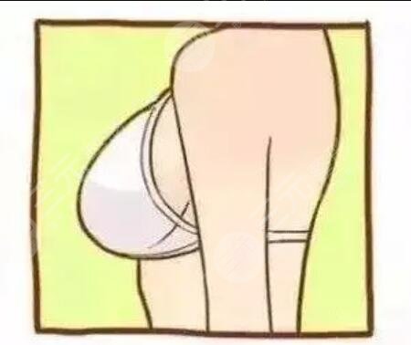 【c罩杯有多大圖片】隆胸筆記