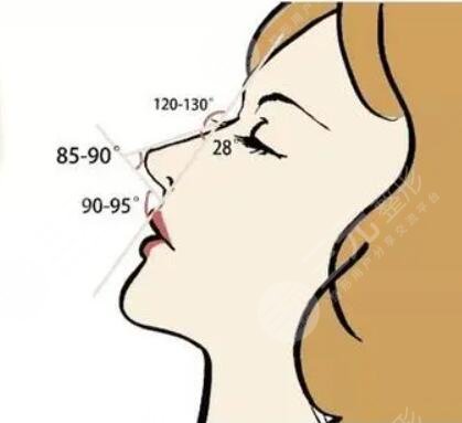 隆肋骨鼻子20天恢復(fù)圖