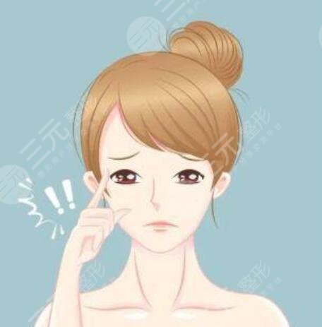 埋線雙眼皮20天恢復(fù)圖