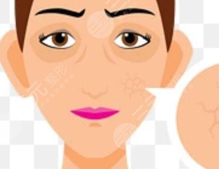 面部埋線除皺術(shù)前準備