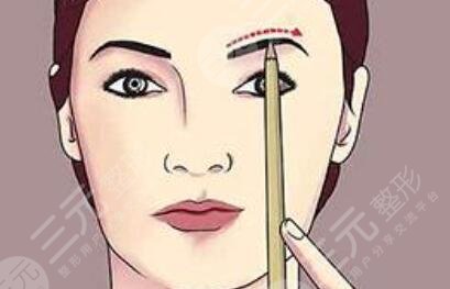 激光洗眉十天后照片，恢復(fù)全過程記錄