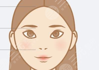 塌鼻子打玻尿酸果圖恢復(fù)中