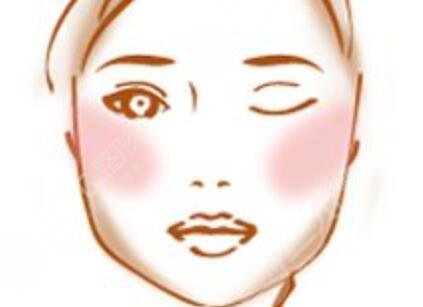 四川嬌點姜宇綠下頜角截骨手術(shù)之后的1年