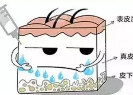 打注射補水前后對照圖：擁有水嘟嘟好肌膚就是這么簡單地！