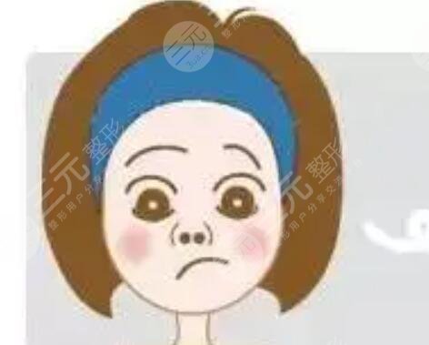 鼻子假體取出恢復(fù)狀況展示，真人記錄術(shù)后恢復(fù)歷程