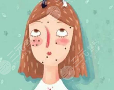 激光去痘印圖片對比