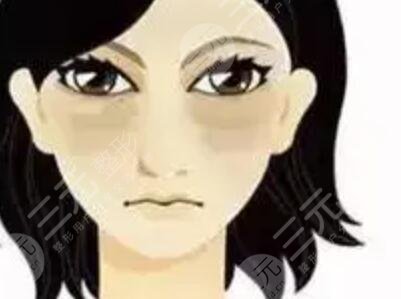 去眼袋手術(shù)圖片對(duì)比：從憔悴到元?dú)鉂M滿的轉(zhuǎn)變！