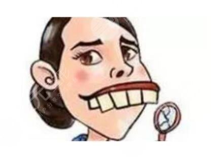 磨下頜角失敗案例