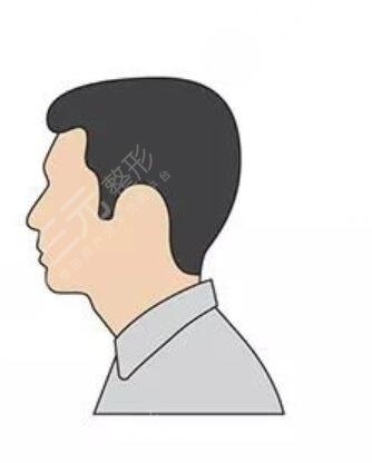 杭州植發(fā)醫(yī)院排行榜