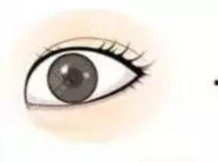 成都華人醫(yī)聯(lián)整容醫(yī)院怎么樣？整形醫(yī)生信息+雙眼皮案例