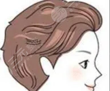 上海長征醫(yī)院整形外科植發(fā)果