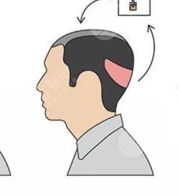 南昌碧蓮盛植發(fā)醫(yī)院地址