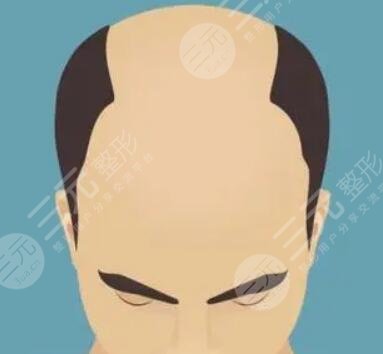 昆明新生植發(fā)醫(yī)院醫(yī)生介紹