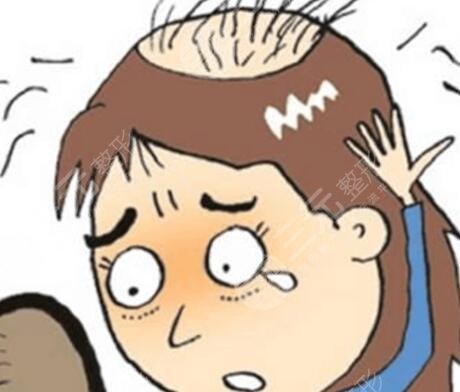 西京醫(yī)院植發(fā)韓鳳華怎么樣