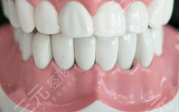 瑞士進(jìn)口種植牙