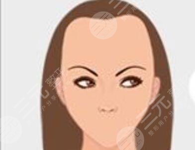 河北省人民醫(yī)院植發(fā)