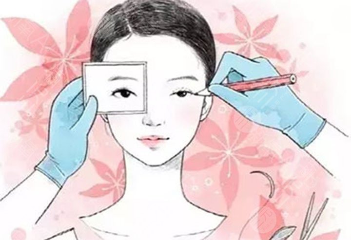 雙眼皮手術(shù)前