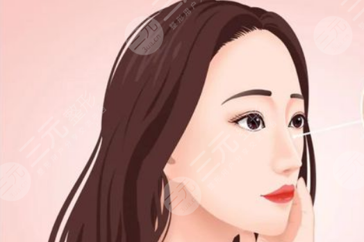 昆山達(dá)拉斯劉波隆鼻案例 術(shù)前