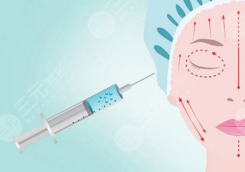 杭州藝星蔣錚錚