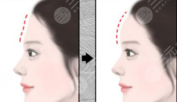 杭州藝星蔣錚錚