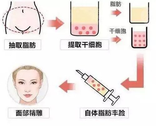 杭州藝星蔣錚錚