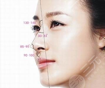 八大處范飛隆鼻整形圖片：術(shù)后3個月恢復(fù)狀態(tài)參考！