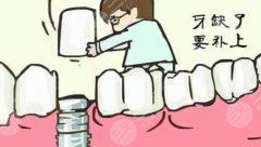 種植牙有什么風(fēng)險(xiǎn)和后遺癥？危害大嗎？科普解答，消除擔(dān)憂！