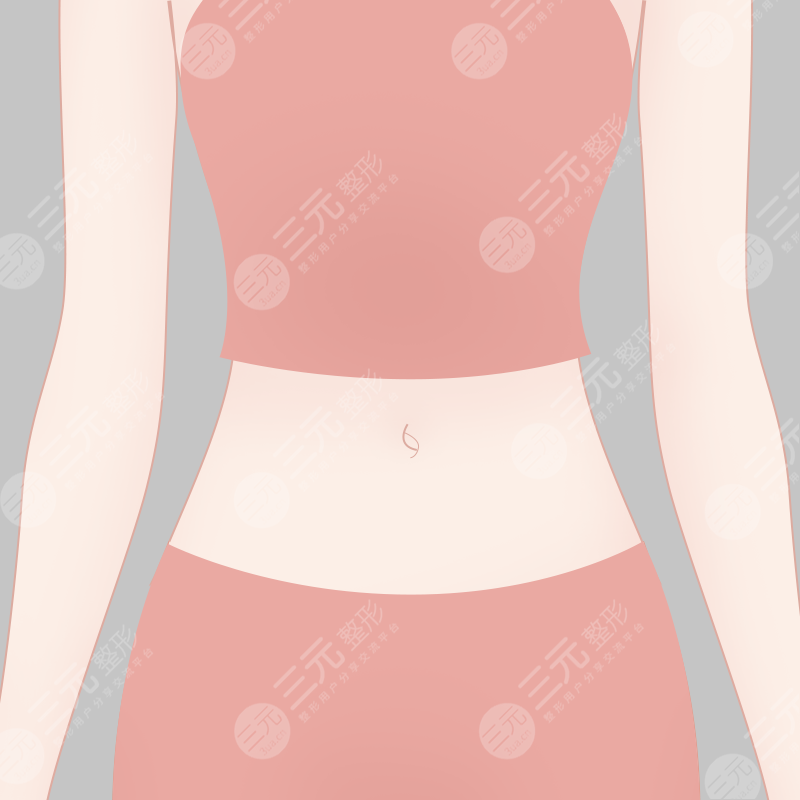 寧波市第六醫(yī)院整形科吸脂案例術(shù)前