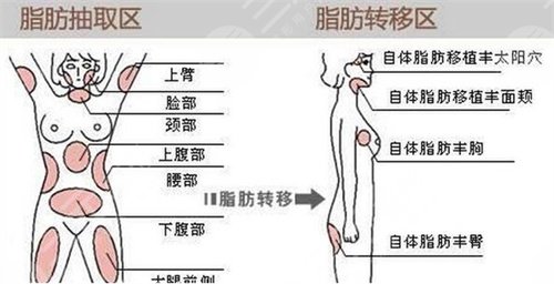 面部年輕化案例前