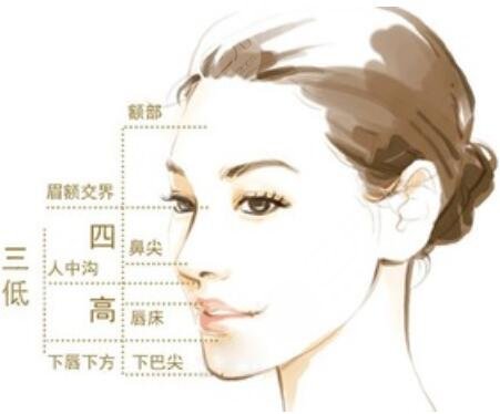 西京整形醫(yī)院假體墊下巴真實案例分享