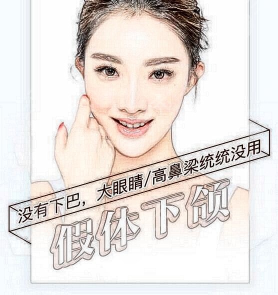 西京整形醫(yī)院假體墊下巴真實案例分享