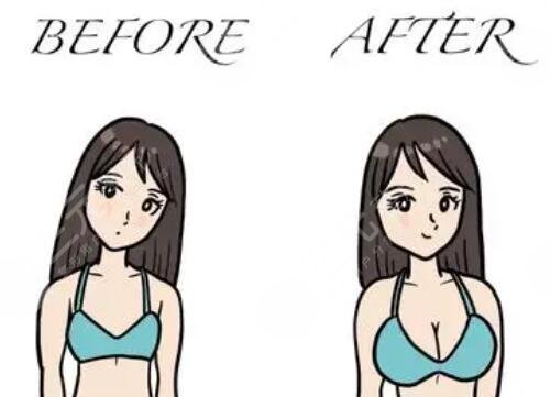 毛面假體和光面假體哪個(gè)好？隆胸假體型號(hào)分析_假體隆胸術(shù)前術(shù)后注意事項(xiàng)