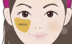 脂肪填充蘋果肌會(huì)不會(huì)下垂？科普解答優(yōu)點(diǎn)&注意事項(xiàng)，你的術(shù)前指南！