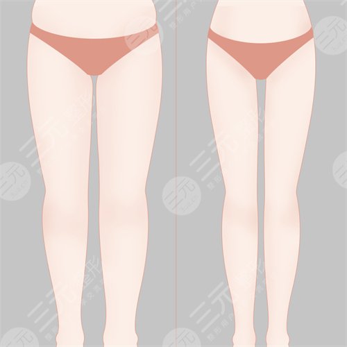 北京星醫(yī)匯醫(yī)療美容吸脂瘦大腿