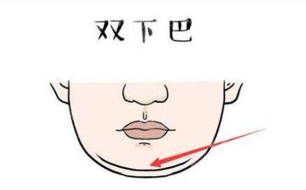 雙下巴