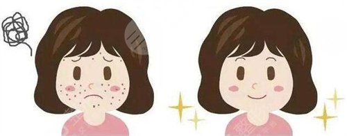 中國醫(yī)學科學院皮膚病醫(yī)院祛斑案例