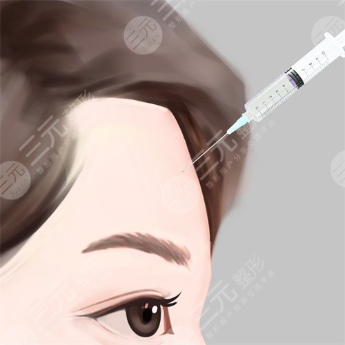 脂肪填充臉部案例分享