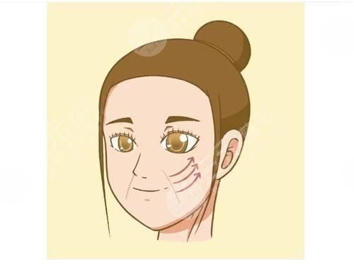 賽諾秀5D膠原光價格多少錢？操作原理&果圖超全分享！